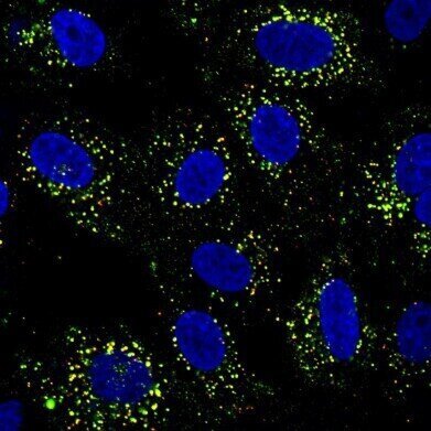 Dengue rewires immunity, shaping vaccine response