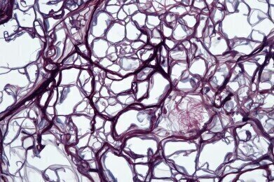 Millions with hepatitis B may avoid routine liver cancer checks