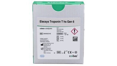 Sixth-generation test transforms emergency heart attack diagnosis