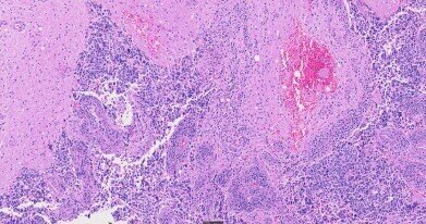 CE-marked whole slide scanner for clinical diagnostic workflows