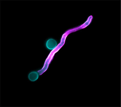 UK scientists lead global effort to combat antifungal resistance