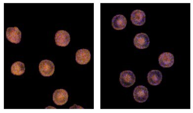 Microscopy uncovers ‘hidden record’ of blood sugar history