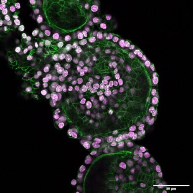 Cryopreservation made simple, reliable, and cost-effective