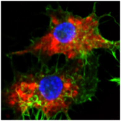 Chemotherapy drug transformed by SNA nanotherapy into powerful targeted cancer treatment