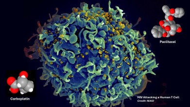 Chemotherapy-linked action on HIV-infected T cell clones points to potential strategy to find a cure for disease