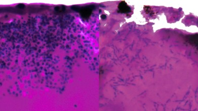 Genetic vulnerability in deadly Candida auris offers potential drug target