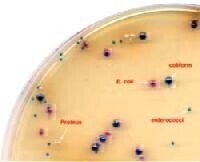 New Chromogenic Uti Medium is Launched: New Clarity Agar Improves Differentiation of Uti Pathogens 