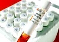 Cod Tests Now Available for All Instruments