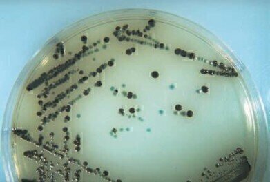 Easy as ABC the identification of Salmonella species.