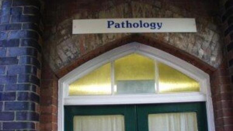 Improving alkaloid selectivity and resolution by adjusting the pH of the mobile phase