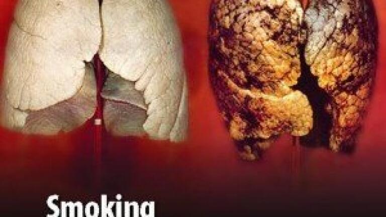 Biocartis and Nichirei Bioscience Announce Collaboration for the Japanese Market