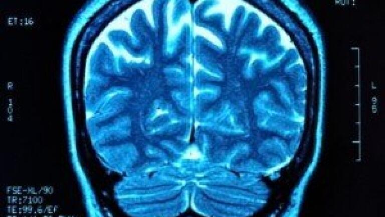 Pilot trial tests Decellularised Skin Grafts