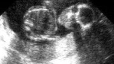 UK Pioneering Technology used for Pre-Clinical Study to Deliver Enhanced Cell Re-Population