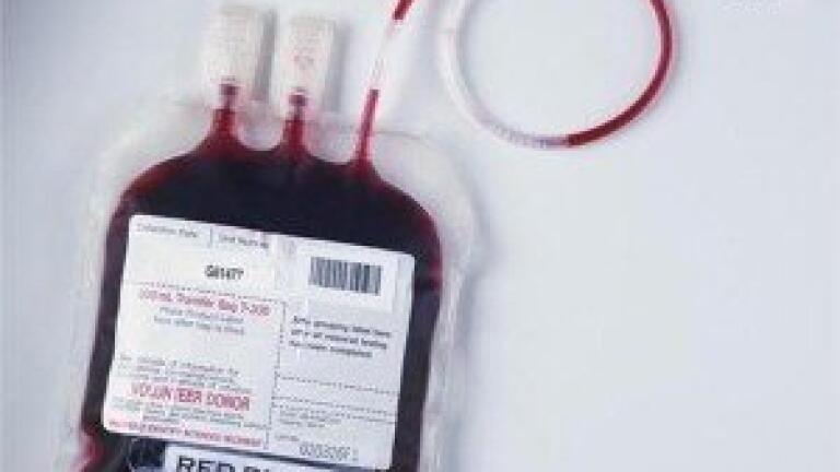 Cresset and Redx Pharma partner