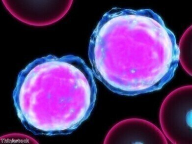 US Researchers Find Method to Block Cancer Stem Cell Differentiation