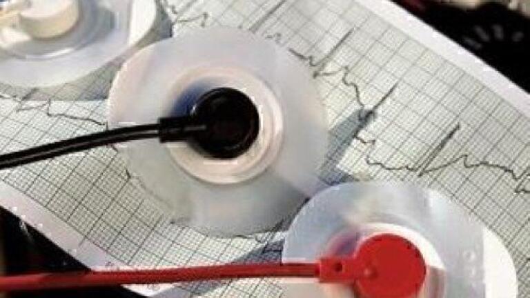 Diagnostics Marketing Manager Joins BBI