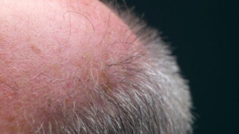 Rhenovia Set to Develop in Key Market Areas